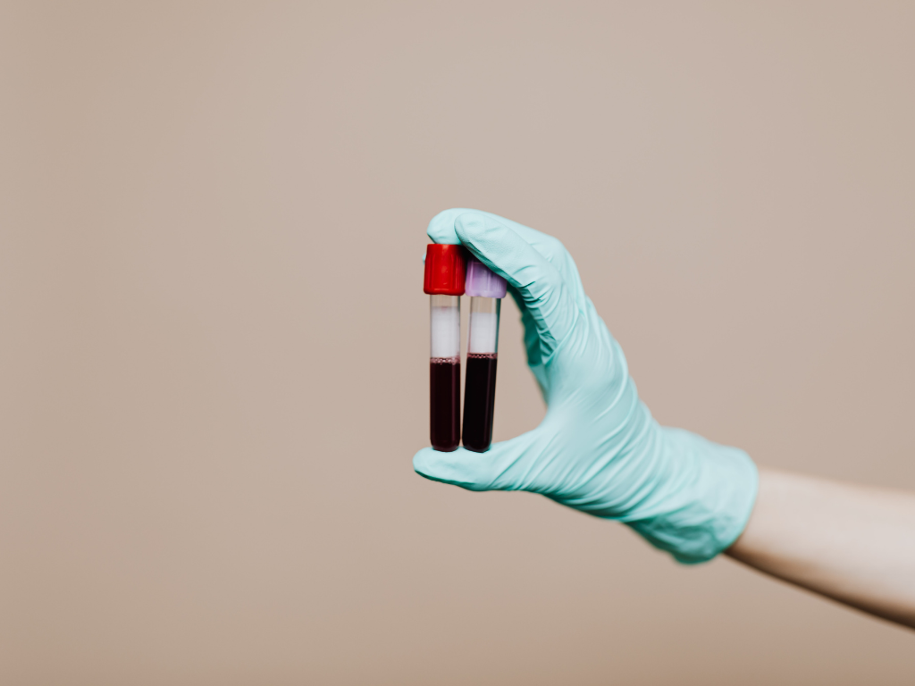 Hemograma sinais de deficiencia de ferro Integralmed